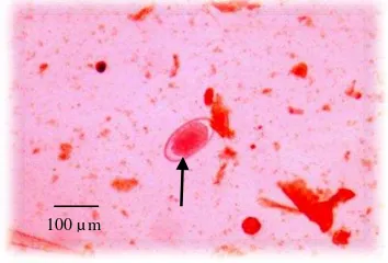 Gambar 2 Telur cacing  H. contortus diamati  menggunakan mikroskop cahaya perbesaran 100x