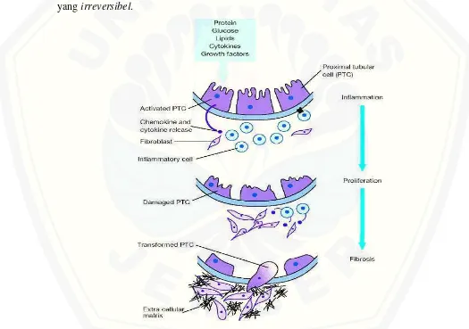 Gambar 2.4 Patomekanisme Terjadinya Parut Tubulointerstisial  (Sumber: Rachmadi et al, 2010) 