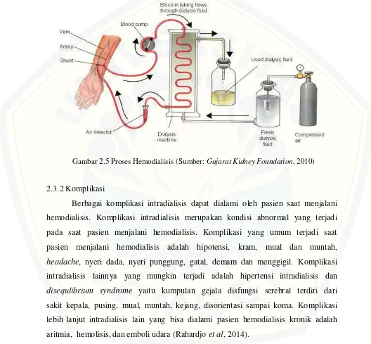 Gambar 2.5 Proses Hemodialisis (Sumber: Gujarat Kidney Foundation, 2010) 