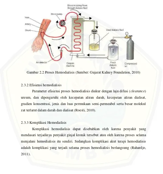 Gambar 2.2 Proses Hemodialisis (Sumber: Gujarat Kidney Foundation, 2010) 