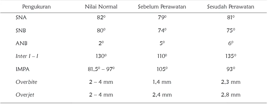 Tabel 1.  Pengukuran sefalometri sebelum dan sesudah perawatan