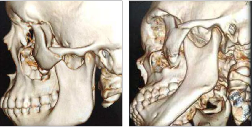 Gambar 3. Rontgen CT Scan  axial
