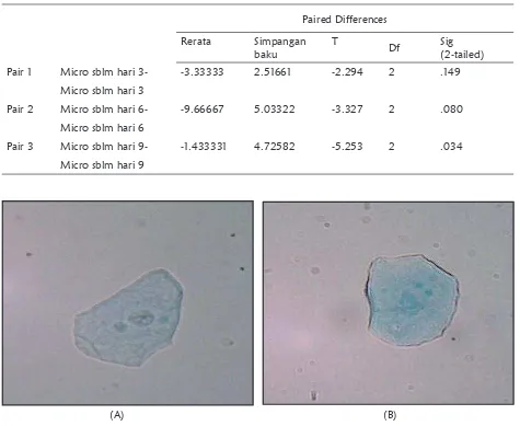 Tabel 1.  Hasil analisis uji normalitas jumlah  mikronukleus kelinci pada kelompok hari ke-3, 6  dan 9  sesudah paparan radiografi panoramik