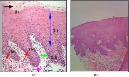 Gambar 3. Persamaan struktur antara mukosa gingiva manusia dan kelinci. (A) Mukosa gingiva manusia (i) lapisan keratin, (ii) stratum spinosum, (iii) lapisan basal, (iv) retepegs, (v) lamina propria