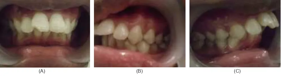 Gambar 1. Foto ekstra oral pasien sebelum perawatan