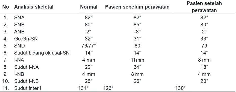 Tabel 1.  Pemeriksaan sefalogram metode Steiner setelah perawatan