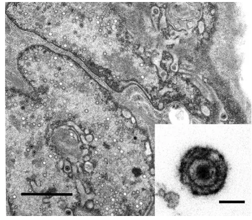 Gambar 1.  Virion dari koi herpesvirus (KHV) yang tumbuh di sel KF-1 terinfeksi. 