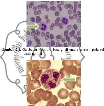 Gambar 2.1. Gambaran Neutrofil batang  di antara eritrosit pada sel 