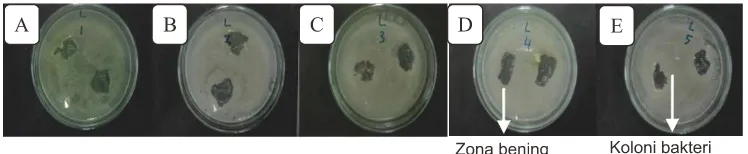 Gambar 9. C) Scaffold setelah dilepas terhadap bakteri S.aureus A) sampel A, B) sampel B, sampel C, D) sampel D, E) sampel E