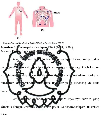 Gambar 1.  Penempatan Sadapan EKG (Nott, 2008) 