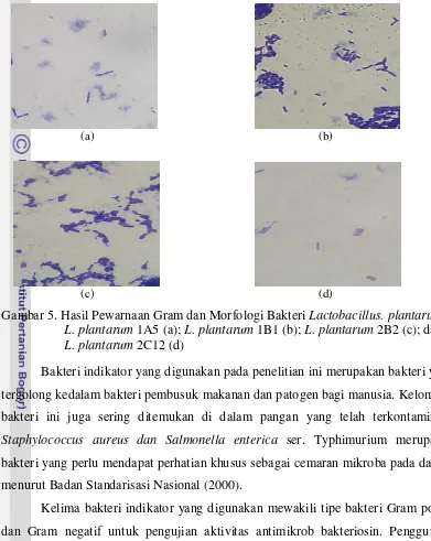 Gambar 5. Hasil Pewarnaan Gram dan Morfologi Bakteri Lactobacillus. plantarum : 