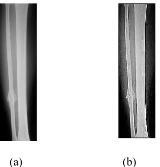 Gambar 3.9. Citra hasil sharpening. (a) citra grayscaling (b) Citra sharpening 