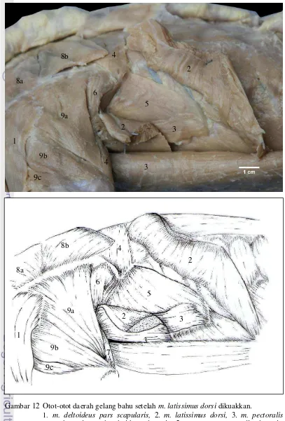 Gambar 12 Otot-otot daerah gelang bahu setelah m. latissimus dorsi dikuakkan. 1. m. deltoideus pars scapularis, 2