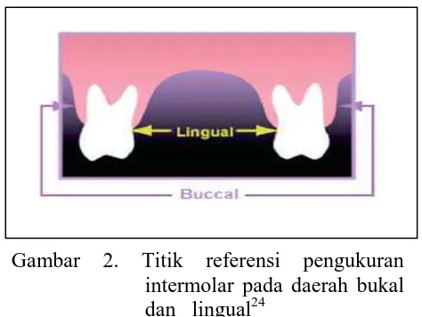 Gambar 3. Titik referensi dalam pengukuran    panjang lengkung gigi 25 