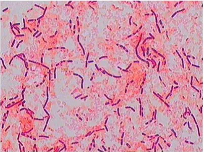 Gambar 6. Hasil pewarnaan isolat AP-17. Sel bakteri berbentuk batang dan memiliki endospora