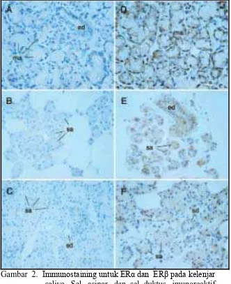 Gambar  2.  Immunostaining untuk ERα dan  ERβ pada kelenjar saliva.  Sel   asinar   dan  sel  duktus   imunoreaktif 