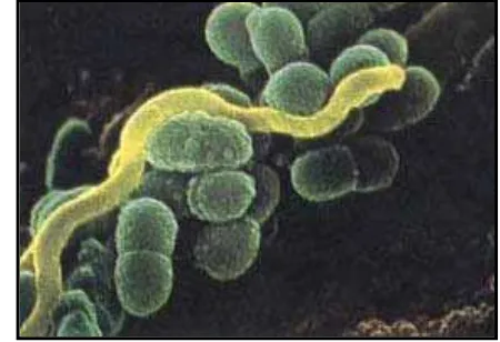 Gambar 3.Streptococcus mutans dilihat dari  mikroskop elektron 14 