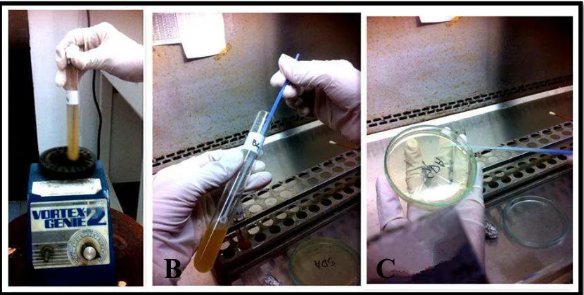 Gambar 6. Prosedur penanaman Candida spp. A) sampel di vibrasi dengan   
