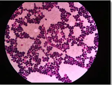 Gambar 3.  Candida spp dilihat dari  mikroskop  elektron (dokumentasi)  
