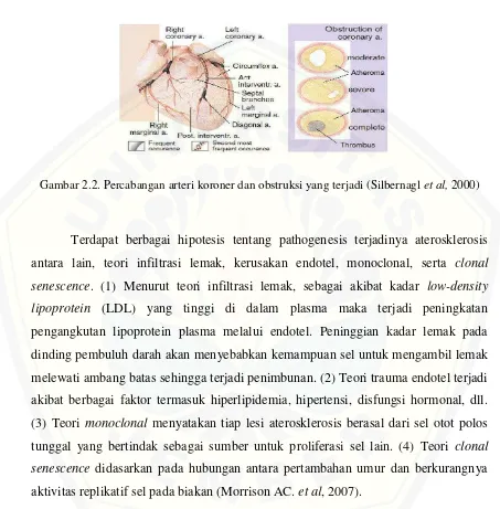 Gambar 2.2. Percabangan arteri koroner dan obstruksi yang terjadi (Silbernagl et al, 2000) 