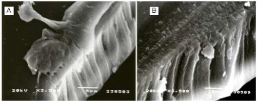 Fig 2. Microphotographs of (A) control; (B) run-28; (C) run-35 chitosan-alginate membranes surface (lateral section) at 10,000 times magnification 