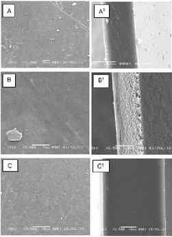 Fig 2. SEM images of film surface of chitosan (A),chitosan-silica (B) and and (chitosan-silica-PEG (C).Superscript shows image of cross surface