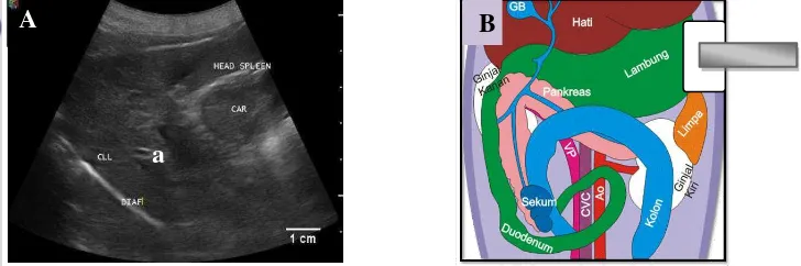 Gambar 7 Sonogram organ hati anjing kasus. A: sonogram organ hati, B: posisi probe 