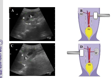 Gambar 10 Sonogran ginjal anjing kasus. A: Sonogram organ ginjal kiri, B: Posisi probe secara sagital untuk pencitraan organ ginjal kiri (Noviana et al