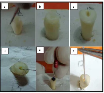 Gambar 11. (a) preparasi ferrule, (b) gigi dengan ferrule, (c) gigi tanpa ferrule, (d) ekstirpasi saluran akar, (e) preparasi saluran akar, (f) pengeringan dengan paper point  