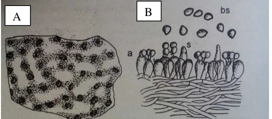 Gambar 1 Struktur Mikrokopis (A). R. microporus (B). Basidium (a), basidiospora, (bs), sistidium (s), (Semangun, 2000) 