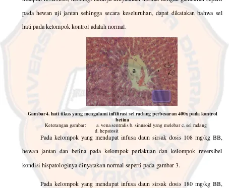 Gambar4. hati tikus yang mengalami infiltrasi sel radang perbesaran 400x pada kontrol 