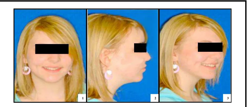 Gambar 4.  (1) Foto frontal bibir tersenyum, (2) Foto profil, (3) Foto profil 45° bibir  tersenyum17 