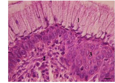 Gambar 12 Serviks uterus tampak (1) epitel silindris sebaris, (2) lamina propria, 