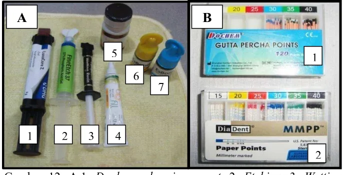 Gambar 12. A.1.  Dual cured resin cement, 2. Etching, 3. Wetting resin cement, 4. Sealer (liquid), 5