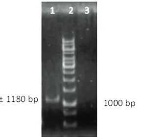 Gambar 2. Hasil identifikasi virus pada tanaman melon bergejala daun keriting dengan PCR, divisualisasidengan gel agarose 1% (lajur 1: sampel tidak bergejala daun keriting (kontrol negatif); lajur 2:cabai terinfeksi Begomovirus (kontrol positif); lajur 3: tanaman melon dengan gejala leaf curl;lajur 4: marker 1 kb DNA ladder)