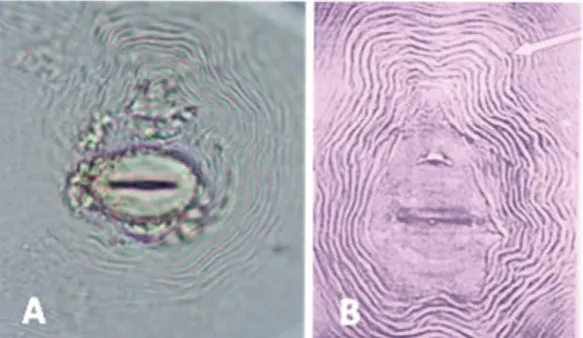 Gambar 7. Morfologi nematoda betina yang hasil isolasi dari akar lada bergejala penyakit kuning di KalimantanBarat: nematoda puru akar betina (A); bagian anterior nematoda betina (B)