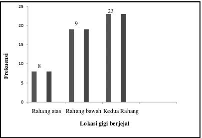 Grafik 1. Distribusi lokasi gigi berjejal pada siswa SMAN 4 Medan. 