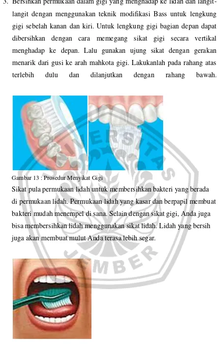 Gambar 14 : Prosedur Menyikat Gigi 