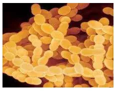 Gambar 2. Streptococcus thermophilus (www. buyprobiotics.com) 