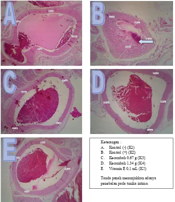 Gambar 1. Histopatologi aorta dengan pembesaran 40 kali dengan pengecatan HE dan pengukuran dengan software image raster at scope image