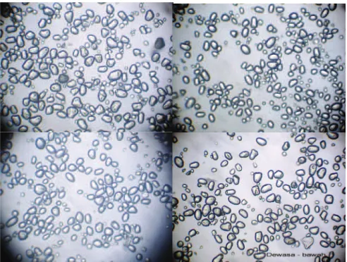 Gambar 1. Granula pati sagu dari batang pada fase dewasa (9 th, kiri atas), jantung (10 th, kanan atas), rusa (11 th, kiri bawah), dan bunga (12 th, kanan bawah).