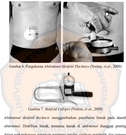 Gambar 6. Pengukuran Abdominal Skinfold Thickness (Norton, et.al., 2000)