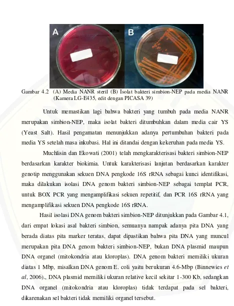 Gambar 4.2  (A) Media NANR steril (B) Isolat bakteri simbion-NEP pada media NANR 