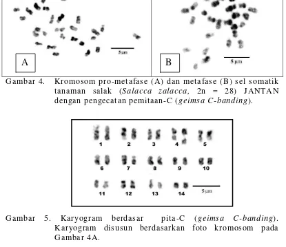 Gambar 4.   Kromosom pro-metafase (A) dan metafase (B) sel somatik tanaman salak (Salacca zalacca, 2n = 28) JANTAN dengan pengecatan pemitaan-C (geimsa C-banding)
