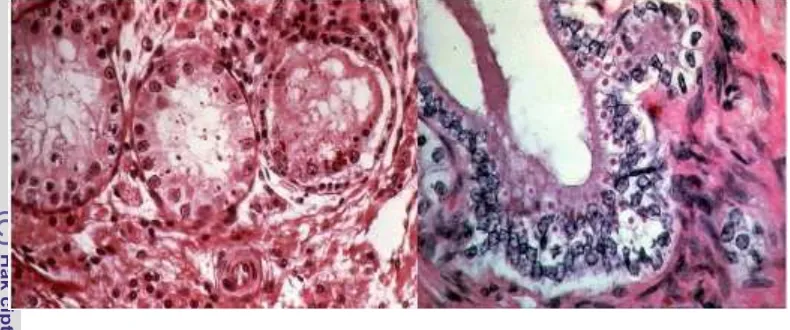 Gambar 5 Histopatologi badan inklusi CDV pada organ (a) sitoplasma epitel vesica 