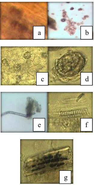 Figure 2: Upper epidemis (a), lower epidermis (b), lithosis cell (c), pallisade tissue (d), cover hair (e), mesophil (f) and parenchim (g) of mulberry leaves 
