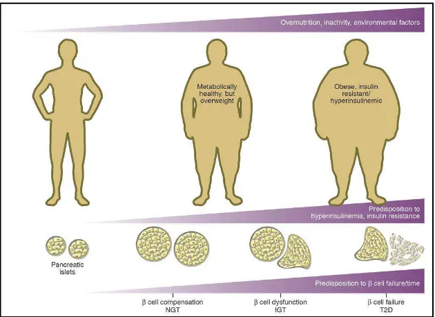 Gambar 2.2 Hubungan berat badan dan fungsi sel beta pankreas 