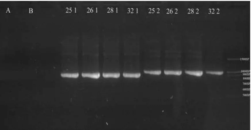 Gambar 3.  Hasil Elektroforesis Gel Agarose dari Amplifikasi DNA pengkode 16S rRNA 