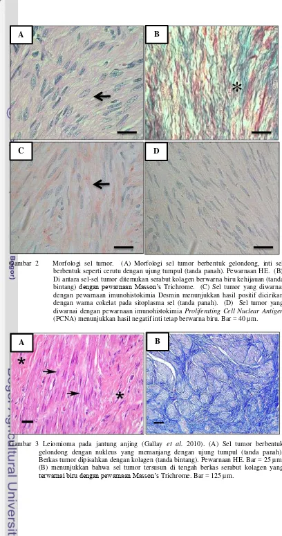 Gambar 3 Leiomioma pada jantung anjing (Gallay et al. 2010). (A) Sel tumor berbentuk 