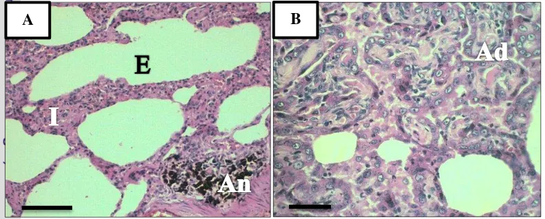 Gambar 4  Gambar histopatologi paru-paru. (A) Alveol mengalami pelebaran (emfisema) (E), 